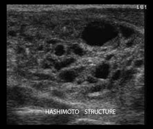 Натисни за увеличение