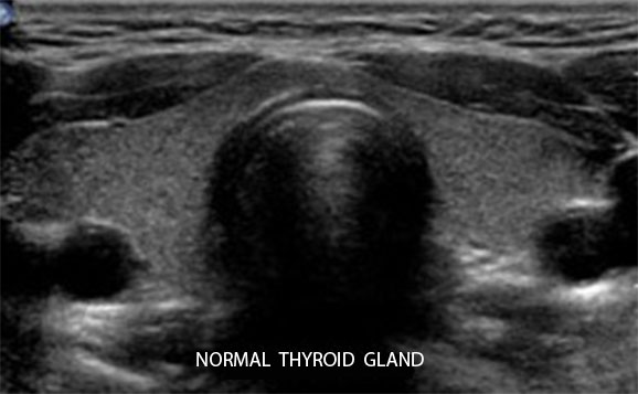 Натисни за увеличение